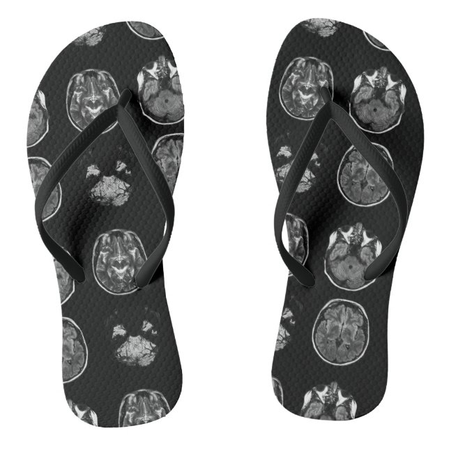 Brain MRI scan Flip Flops (Footbed)