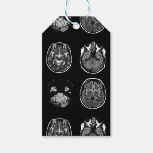 Brain MRI scan Gift Tags