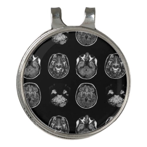 Brain MRI scan Golf Hat Clip