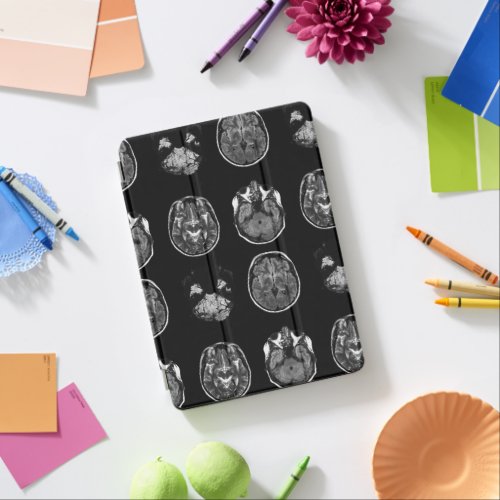 Brain MRI scan iPad Air Cover