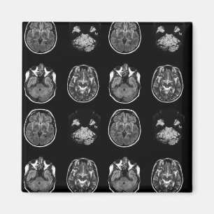 Brain MRI scan Magnet