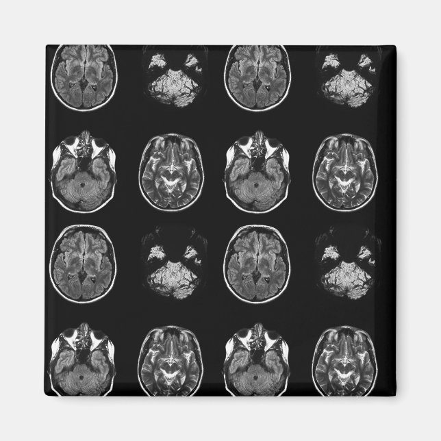 Brain MRI scan Magnet (Front)