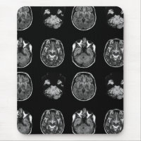 Brain MRI scan