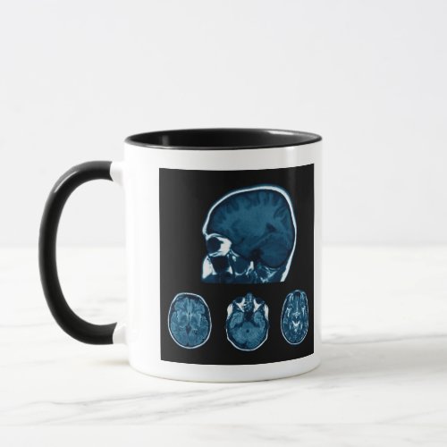 Brain Mri scan Mug
