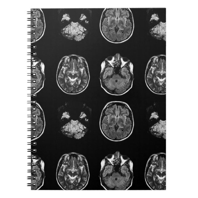 Brain MRI scan Notebook (Front)
