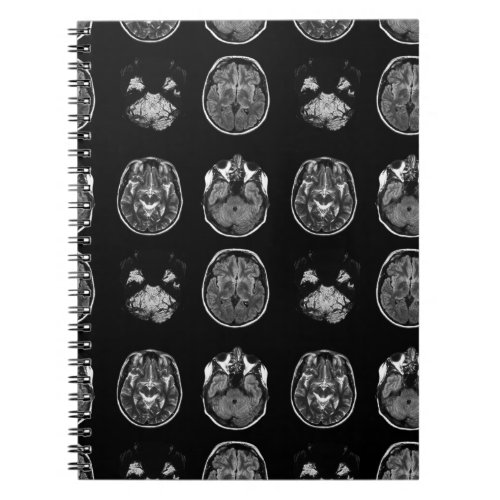 Brain MRI scan Notebook