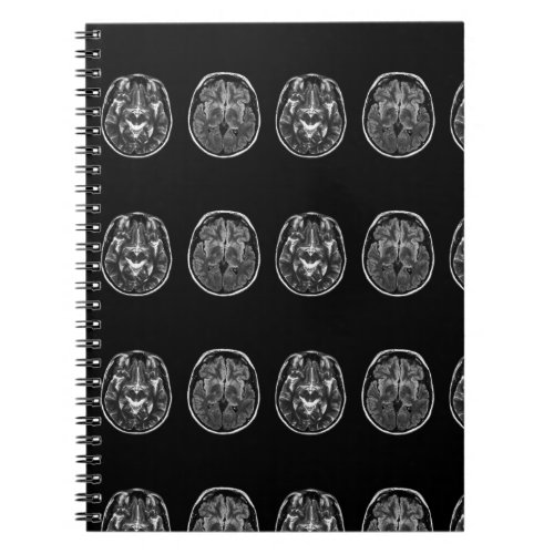 Brain mri scan notebook