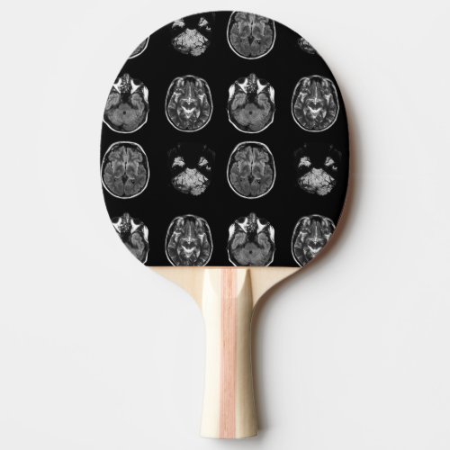 Brain MRI scan Ping Pong Paddle