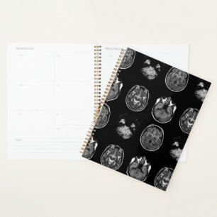Brain MRI scan Planner