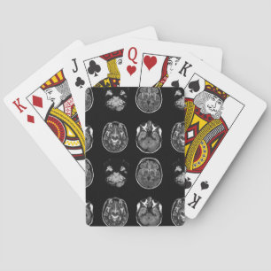 Brain MRI scan Poker Cards