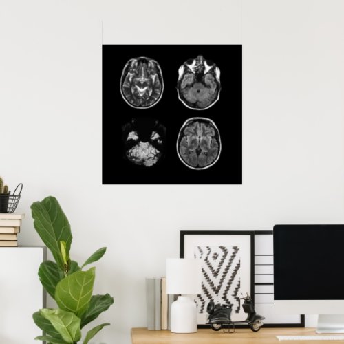 Brain MRI scan Poster