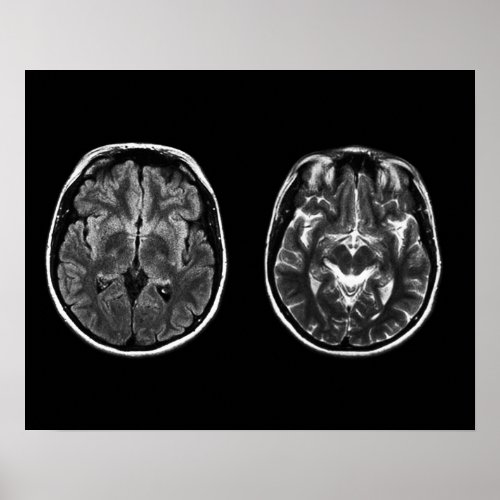 Brain mri scan poster