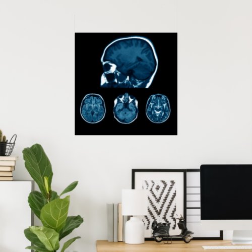 Brain Mri scan Poster