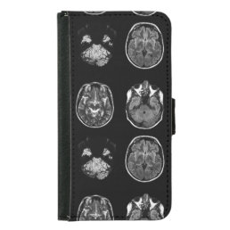 Brain MRI scan Samsung Galaxy S5 Wallet Case