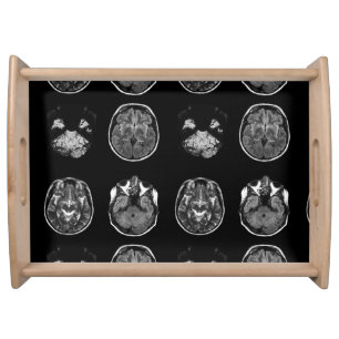Brain MRI scan Serving Tray