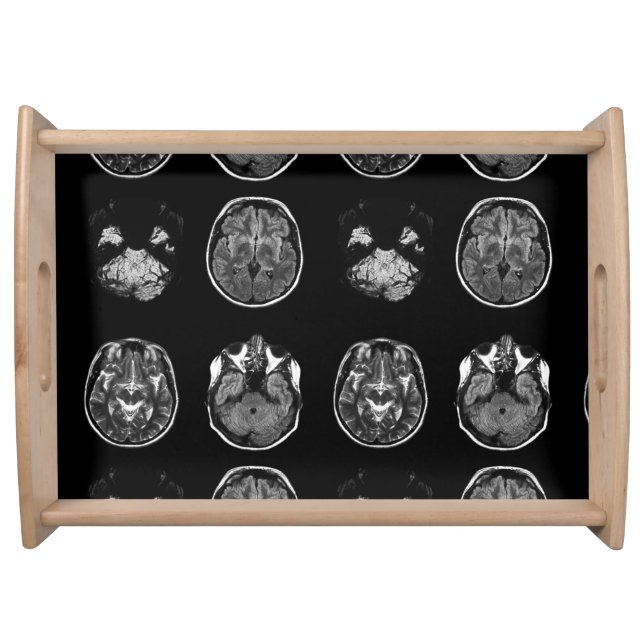 Brain MRI scan Serving Tray (Front)