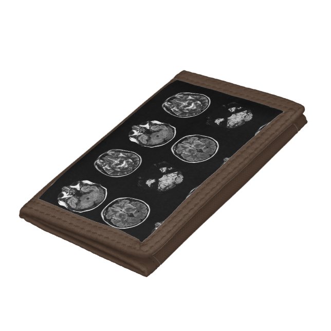 Brain MRI scan Trifold Wallet (Bottom)