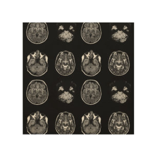 Brain MRI scan Wood Wall Art