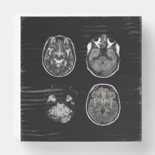 Brain MRI scan Wooden Box Sign