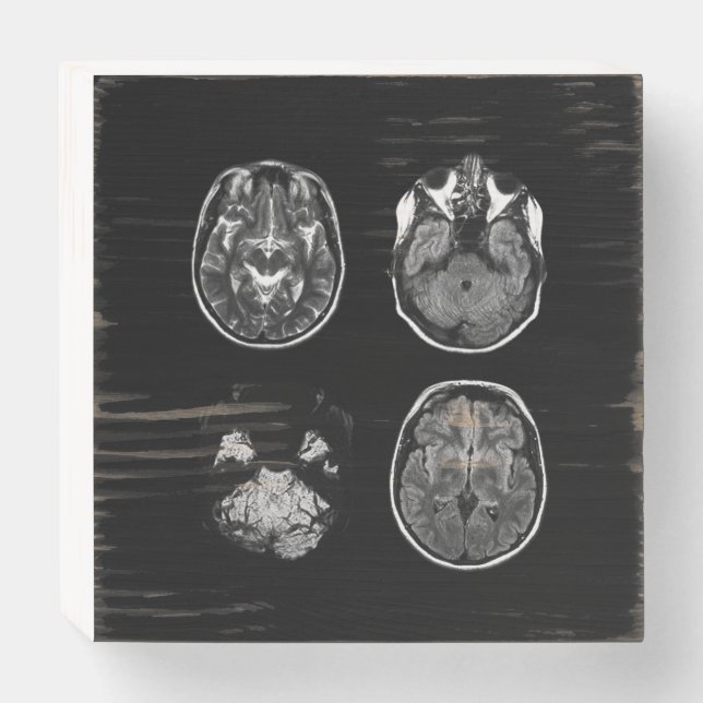 Brain MRI scan Wooden Box Sign (Front Horizontal)
