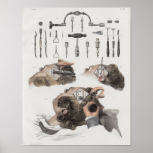 Brain Surgery Instruments Vintage Anatomy Print