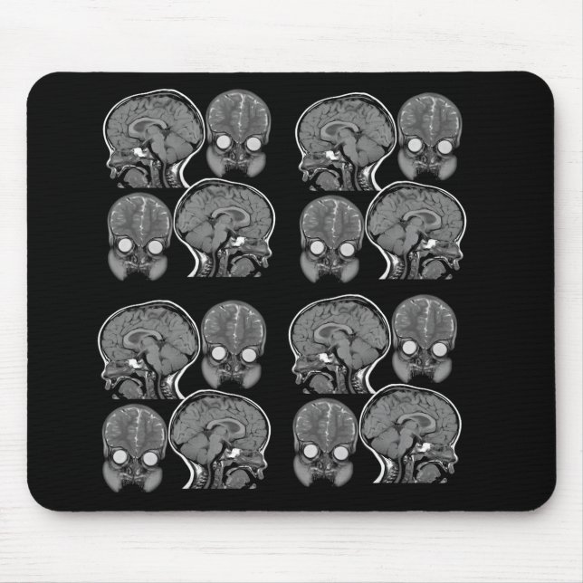 BRAINS! (MRI) MOUSE PAD (Front)