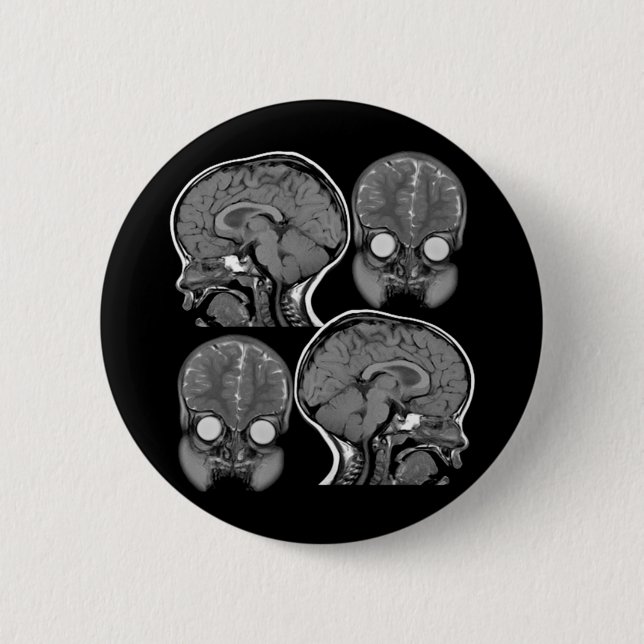 BRAINS! (MRI) PINBACK BUTTON (Front)