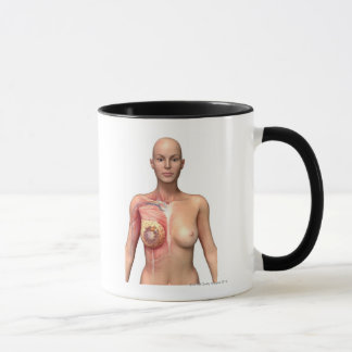 Breast cancer mug
