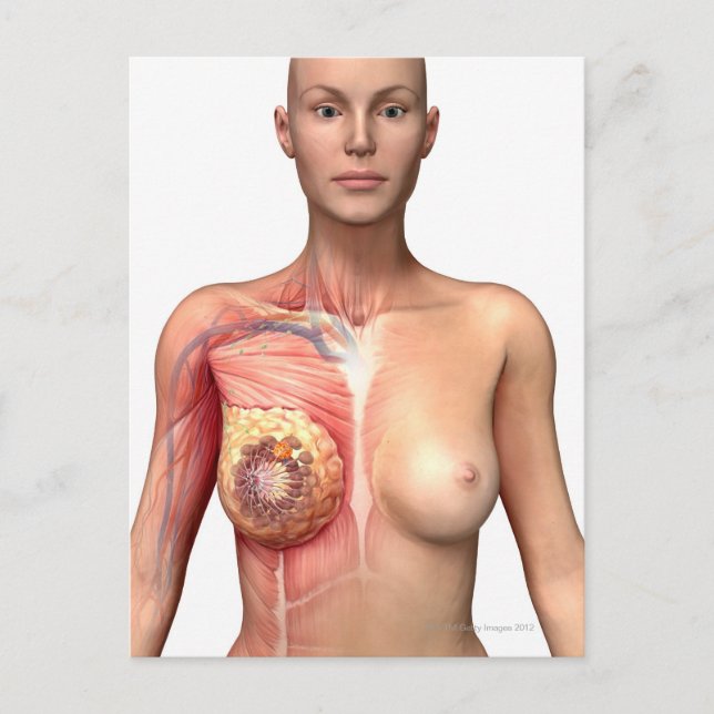 Breast cancer postcard (Front)