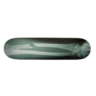 Broken Bones Skateboard Deck