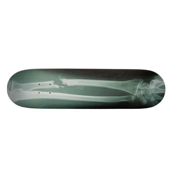 Broken Bones Skateboard Deck Zazzle