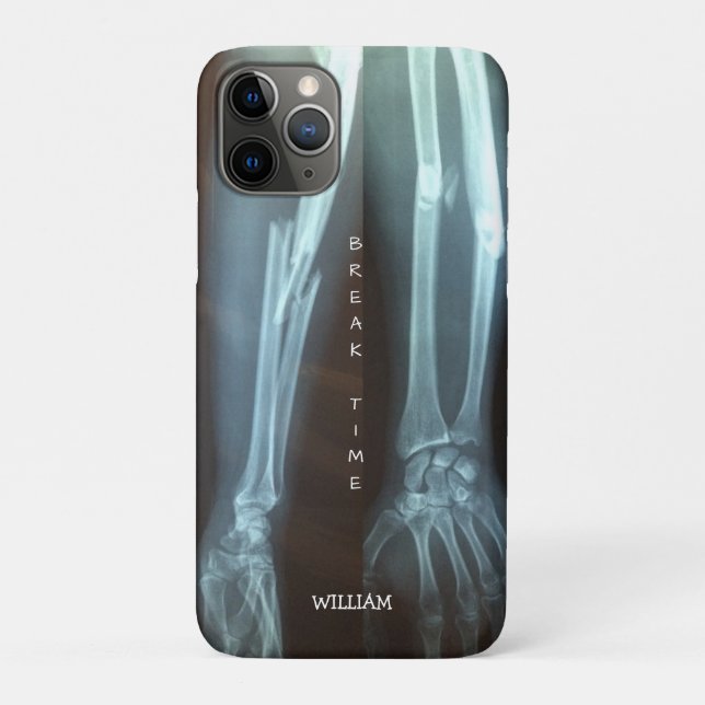 Broken Radius and Ulna Xray "Break Time"    Case-Mate iPhone Case (Back)