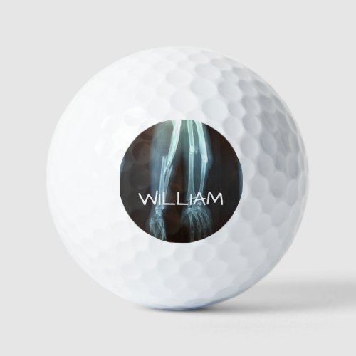 Broken Radius and Ulna Xray Break Time Golf Balls