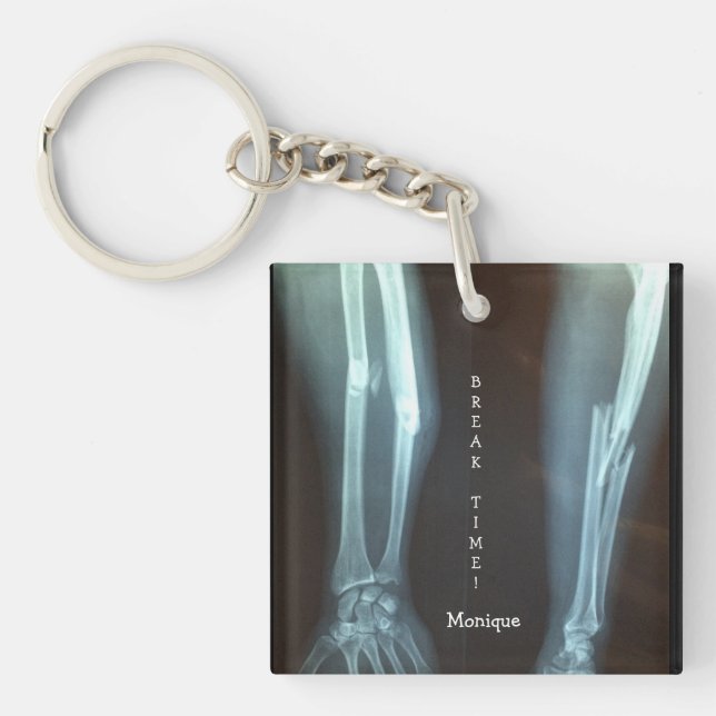 Broken Radius and Ulna Xray "Break Time"   Keychain (Front)