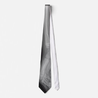 BROKEN WRIST TIE