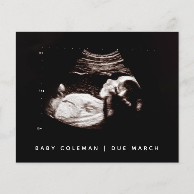 Budget Pregnancy Baby Sonogram Ultrasound Photo Flyer (Front)