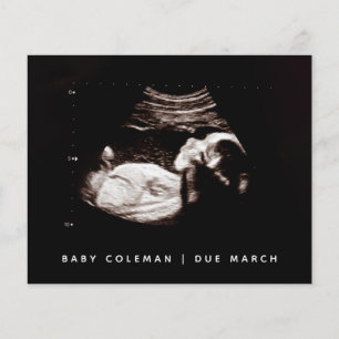 Budget Pregnancy Baby Sonogram Ultrasound Photo Flyer
