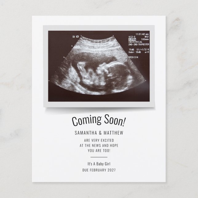 Budget Ultrasound Photo Pregnancy Announcement Flyer (Front)