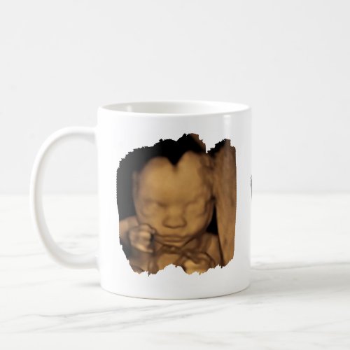 Cant Wait To Meet You Daddy Sonogram Baby Photo Coffee Mug