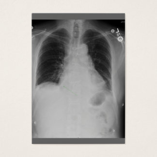 Cardiac Surgery ~ ATC