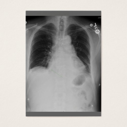 Cardiac Surgery ~ ATC Business Card Templates