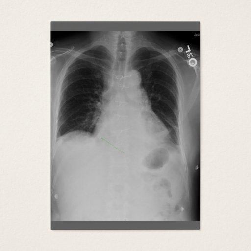 Customizable Cardiac Surgery ~ ATC Business Card Templates