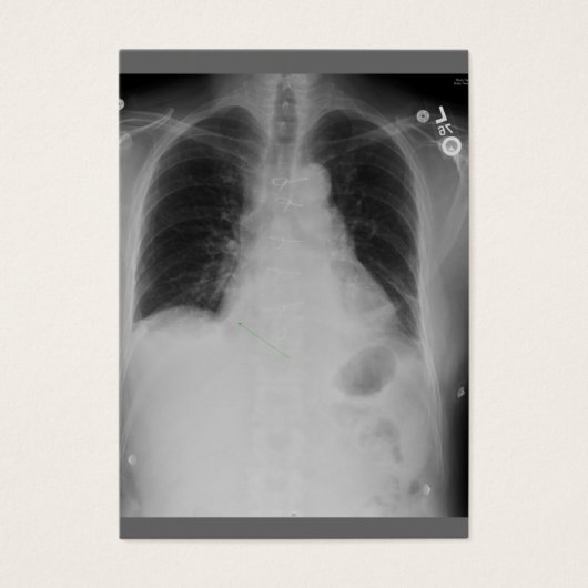 Cardiac Surgery ~ ATC (Front)
