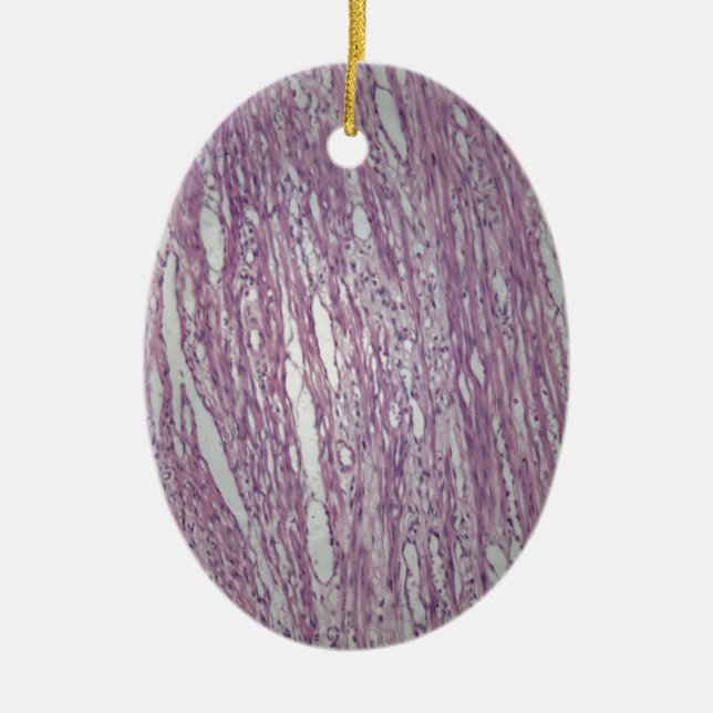 Cells of human uterus tissue with inoffensive tumo ceramic ornament (Front)