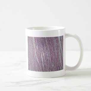 Cells of human uterus tissue with inoffensive tumo coffee mug