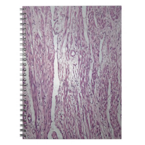 Cells of human uterus tissue with inoffensive tumo notebook
