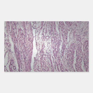 Cells of human uterus tissue with inoffensive tumo rectangular sticker