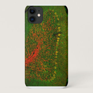 Cerebellum in confocal laser scanning microscopy iPhone 11 case