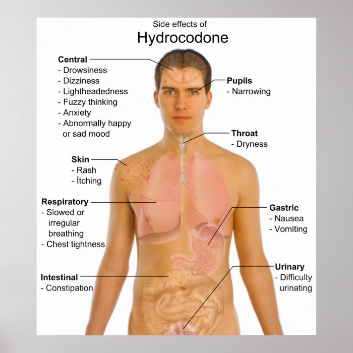 Chart Of The Side Effects Of Opioid Hydrocodone Poster Zazzle 6143