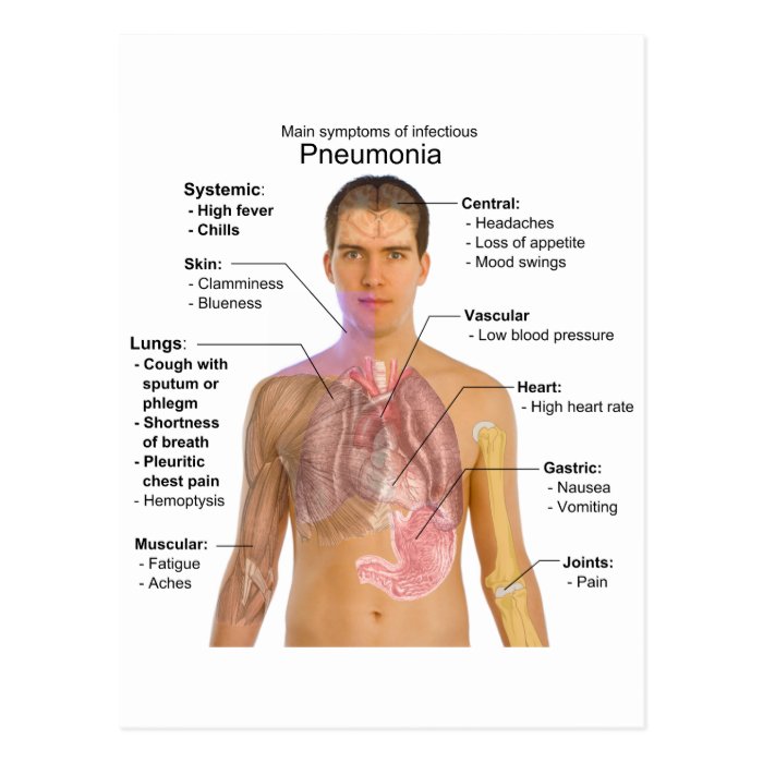 Chart of the Symptoms of Pneumonia Postcard | Zazzle